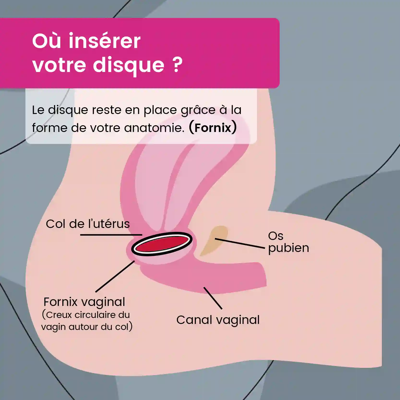 Disque menstruel + pochette de rangement – Image 7