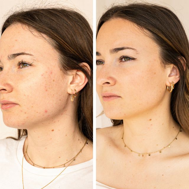 Sérum anti imperfections – Endro Cosmétiques – Image 6